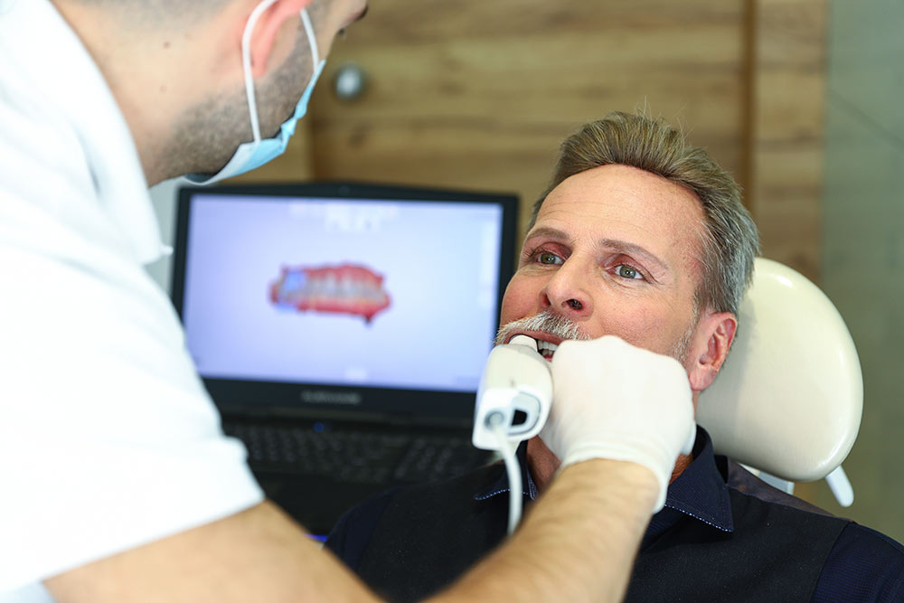 What Are the Advantages of Intraoral Scanners?