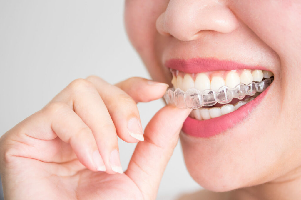 A smiling woman holding invisalign or invisible braces, orthodontic equipment